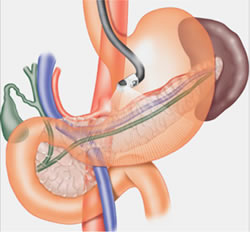 stomach