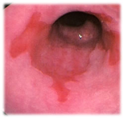 endoscopic view