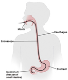 endoscopy